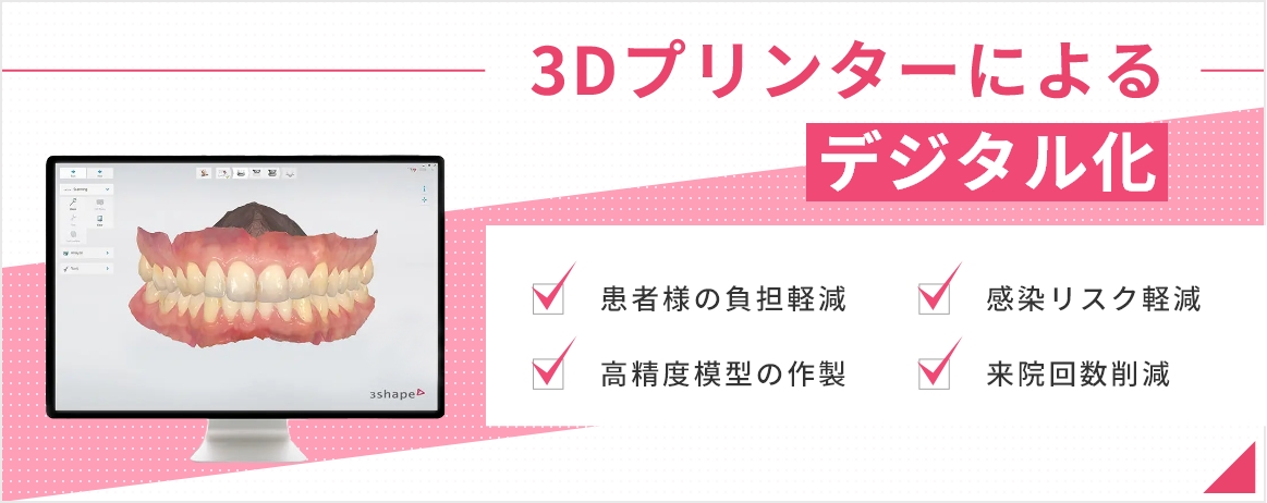 3Dプリンターによるデジタル化